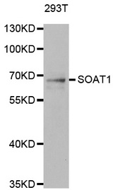 Western blot analysis of extracts of 293T cell line, using SOAT1 antibody.