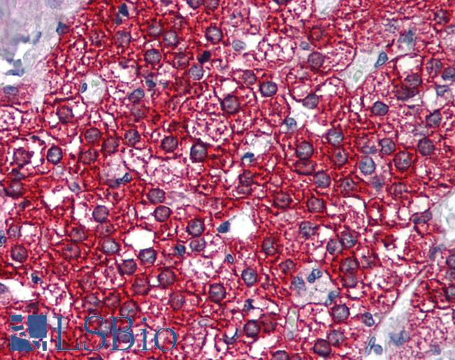 Anti-SOAT1 / STAT antibody IHC of human adrenal. Immunohistochemistry of formalin-fixed, paraffin-embedded tissue after heat-induced antigen retrieval. Antibody LS-B1586 concentration 5 ug/ml.