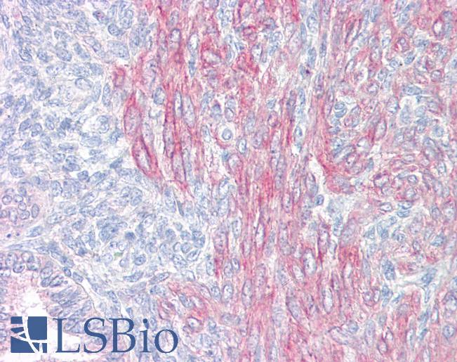 Anti-PAWR / PAR4 antibody IHC of human uterus. Immunohistochemistry of formalin-fixed, paraffin-embedded tissue after heat-induced antigen retrieval. Antibody LS-B7615 concentration 5 ug/ml.