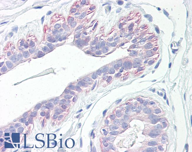 Anti-PAWR / PAR4 antibody IHC of human breast. Immunohistochemistry of formalin-fixed, paraffin-embedded tissue after heat-induced antigen retrieval. Antibody LS-B7615 concentration 5 ug/ml.