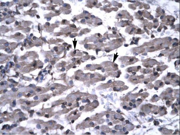 PAWR / PAR4 antibody LS-C29702 was used in IHC to stain formalin-fixed, paraffin-embedded human muscle.