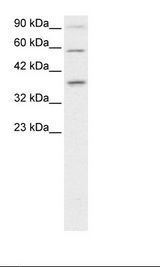 Jurkat Cell Lysate