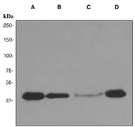 Western blot analysis on (A) LNCap, (B) Jurkat, (C) A549, and (D) HeLa cell lysates using anti-PAR4 antibody (LS-C105758).
