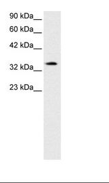 Jurkat Cell Lysate