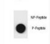 Dot blot of SQSTM1 Antibody (Phospho S207) Phospho-specific antibody on nitrocellulose membrane. 50ng of Phospho-peptide or Non Phospho-peptide per dot were adsorbed. Antibody working concentrations are 0.6ug per ml.
