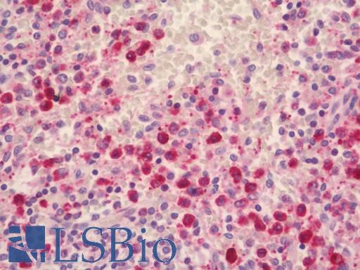 Human Spleem: Formalin-Fixed, Paraffin-Embedded (FFPE)