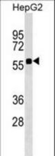 SRCRB4D Antibody western blot of HepG2 cell line lysates (35 ug/lane). The SRCRB4D antibody detected the SRCRB4D protein (arrow).