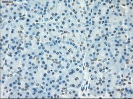 IHC of paraffin-embedded pancreas tissue using anti-SSX2 mouse monoclonal antibody. (Dilution 1:50).