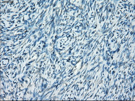 IHC of paraffin-embedded Ovary tissue using anti-SSX2 mouse monoclonal antibody. (Dilution 1:50).