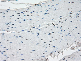 IHC of paraffin-embedded colon tissue using anti-SSX2 mouse monoclonal antibody. (Dilution 1:50).