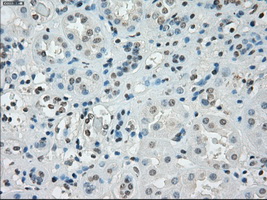 IHC of paraffin-embedded Kidney tissue using anti-SSX2 mouse monoclonal antibody. (Dilution 1:50).