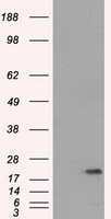 HEK293T cells were transfected with the pCMV6-ENTRY control (Left lane) or pCMV6-ENTRY SSX2 (Right lane) cDNA for 48 hrs and lysed. Equivalent amounts of cell lysates (5 ug per lane) were separated by SDS-PAGE and immunoblotted with anti-SSX2.