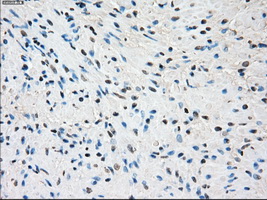 IHC of paraffin-embedded prostate tissue using anti-SSX2 mouse monoclonal antibody. (Dilution 1:50).