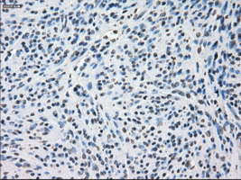 IHC of paraffin-embedded endometrium tissue using anti-SSX2 mouse monoclonal antibody. (Dilution 1:50).