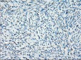 IHC of paraffin-embedded Ovary tissue using anti-SSX2 mouse monoclonal antibody. (Dilution 1:50).