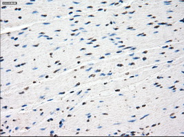IHC of paraffin-embedded colon tissue using anti-SSX2 mouse monoclonal antibody. (Dilution 1:50).