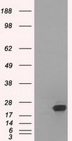 HEK293T cells were transfected with the pCMV6-ENTRY control (Left lane) or pCMV6-ENTRY SSX2 (Right lane) cDNA for 48 hrs and lysed. Equivalent amounts of cell lysates (5 ug per lane) were separated by SDS-PAGE and immunoblotted with anti-SSX2.