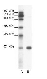 A: Marker, B: Jurkat Cell Lysate