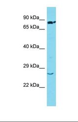 Western blot of Human Lung Tumor. SSX2 antibody dilution 1.0 ug/ml.