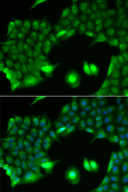 Immunofluorescence analysis of HeLa cell using SSX2 antibody. Blue: DAPI for nuclear staining.