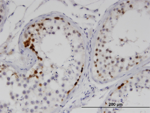 Immunoperoxidase of monoclonal antibody to SSX2 on formalin-fixed paraffin-embedded human testis. [antibody concentration 1.5 ug/ml]