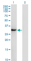 Western blot of SSX2 expression in transfected 293T cell line by SSX2 monoclonal antibody (M01), clone 1A4.