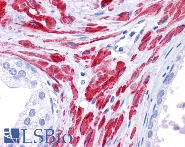 Anti-STAT5B antibody IHC of human prostate. Immunohistochemistry of formalin-fixed, paraffin-embedded tissue after heat-induced antigen retrieval. Antibody LS-B4572 concentration 5 ug/ml.