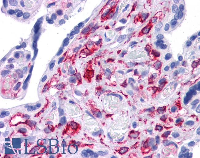 Anti-STAT5B antibody IHC of human placenta. Immunohistochemistry of formalin-fixed, paraffin-embedded tissue after heat-induced antigen retrieval. Antibody LS-B4572 concentration 5 ug/ml.