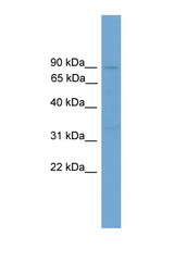STAT5B antibody LS-C116056 Western blot of Mouse Thymus lysate. Antibody concentration 1 ug/ml.