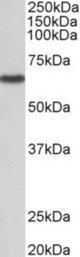 STK3 antibody (1 ug/ml) staining of NIH3T3 lysate (35 ug protein in RIPA buffer). Primary incubation was 1 hour. Detected by chemiluminescence.