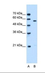 Lane A: Marker. Lane B: Jurkat cell lysate. Antibody concentration: 0.5 ug/ml. Gel concentration: 12%.