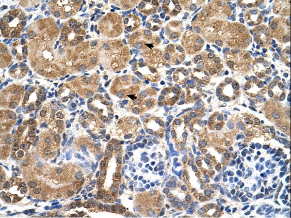 STK3 antibody LS-C81281 was used in IHC to stain formalin-fixed, paraffin-embedded human kidney.