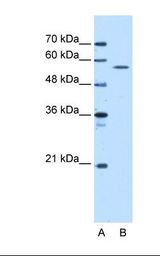 HepG2 cell lysate. Antibody concentration: 5.0 ug/ml. Gel concentration: 12%.