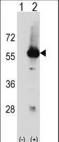 Western blot of Stk3 (arrow) using rabbit polyclonal Mouse Stk3 Antibody. 293 cell lysates (2 ug/lane) either nontransfected (Lane 1) or transiently transfected (Lane 2) with the Stk3 gene.