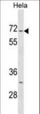 Mouse Stk3 Antibody western blot of HeLa cell line lysates (35 ug/lane). The Stk3 antibody detected the Stk3 protein (arrow).