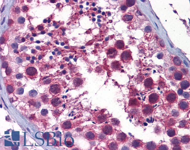 Anti-STK38 antibody IHC of human testis. Immunohistochemistry of formalin-fixed, paraffin-embedded tissue after heat-induced antigen retrieval. Antibody LS-B6231 concentration 1 ug/ml.