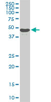 Antibody LS-B6231, Western blot of STK38 expression in PC-12.
