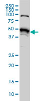 Antibody LS-B6231, Western blot of STK38 expression in HeLa NE.