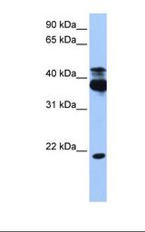 HepG2 cell lysate. Antibody concentration: 1.0 ug/ml. Gel concentration: 12%.