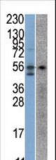 The anti-STK38 antibody is used in Western blot to detect STK38 in SK-Br-3 (left) and Jurkat (right) cell line lysates.