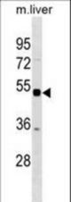 Mouse Stk38 Antibody western blot of mouse liver tissue lysates (35 ug/lane). The Stk38 antibody detected the Stk38 protein (arrow).