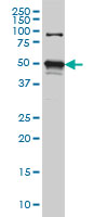 STK38 monoclonal antibody (M02), clone 3A5 Western blot of STK38 expression in HeLa NE.