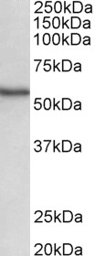 STK38 antibody (0.5 ug/ml) staining of Human Spleen lysate (35 ug protein in RIPA buffer). Primary incubation was 1 hour. Detected by chemiluminescence.