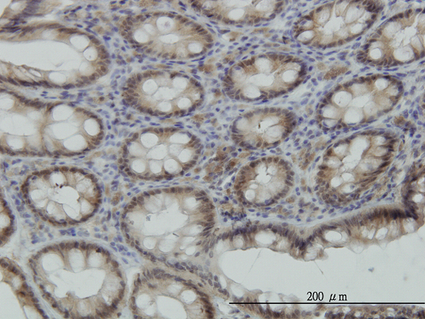 Immunoperoxidase of monoclonal antibody to STK38 on formalin-fixed paraffin-embedded human colon. [antibody concentration 2 ug/ml]