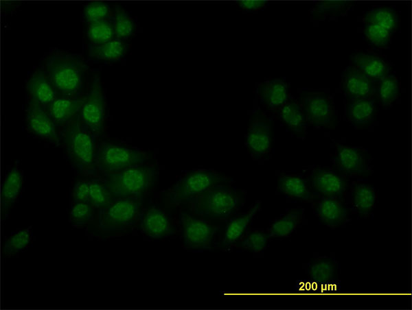 Immunofluorescence of monoclonal antibody to STK38 on HeLa cell. [antibody concentration 10 ug/ml]