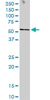 STK38 monoclonal antibody (M11), clone 2F6. Western blot of STK38 expression in human kidney.