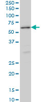 STK38 monoclonal antibody (M11), clone 2F6 Western blot of STK38 expression in HeLa NE.