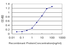 Detection limit for recombinant GST tagged STK38 is approximately 0.3 ng/ml as a capture antibody.