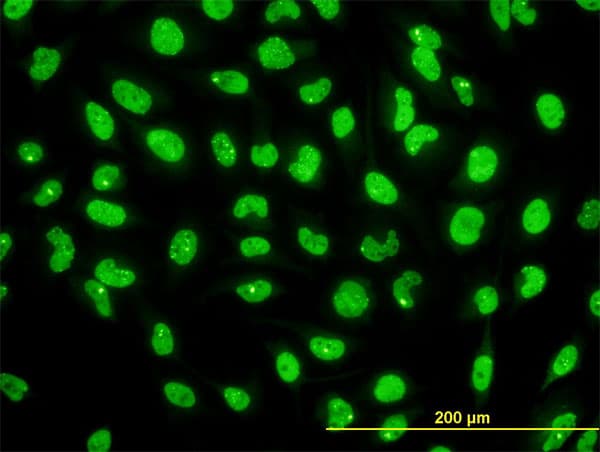 Immunofluorescence of monoclonal antibody to STK38 on HeLa cell. [antibody concentration 10 ug/ml]