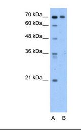 Lane A: Marker. Lane B: HepG2 cell lysate. Antibody concentration: 2.5 ug/ml. Gel concentration: 12%.